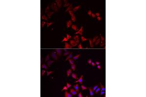 Immunofluorescence analysis of MCF7 cells using PCBD1 antibody.