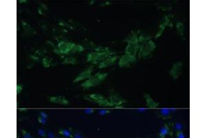 Immunofluorescence analysis of C6 cells using EPHA4 Polyclonal Antibody at dilution of 1:100. (EPH Receptor A4 Antikörper)