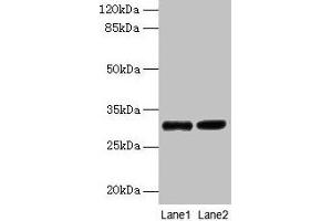 Western blot All lanes: UQCRQ antibody at 2 μg/mL Lane 1: EC109 whole cell lysate Lane 2: 293T whole cell lysate Secondary Goat polyclonal to rabbit IgG at 1/15000 dilution Predicted band size: 10 kDa Observed band size: 30 kDa (UQCRQ Antikörper  (AA 2-78))