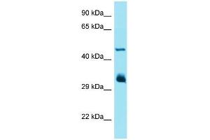 Western Blotting (WB) image for anti-Interferon-Induced Protein with Tetratricopeptide Repeats 1 (IFIT1) (Middle Region) antibody (ABIN2490346) (IFIT1 Antikörper  (Middle Region))