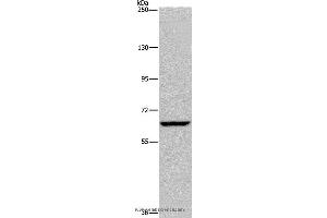 Western blot analysis of Hela cell, using IVL Polyclonal Antibody at dilution of 1:200 (Involucrin Antikörper)