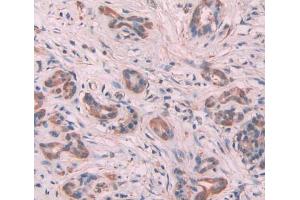 Used in DAB staining on fromalin fixed paraffin- embedded Kidney tissue (MYL6 Antikörper  (AA 4-146))