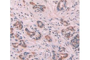 Immunohistochemistry (IHC) image for anti-Myosin Light Chain 6, Alkali, Smooth Muscle and Non Muscle (MYL6) (AA 4-146) antibody (ABIN5013971)