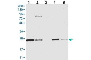 Western blot analysis of Lane 1: RT-4, Lane 2: U-251 MG, Lane 3: Human Plasma, Lane 4: Liver, Lane 5: Tonsil with CCDC90B polyclonal antibody  at 1:250-1:500 dilution. (CCDC90B Antikörper)