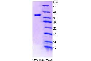 SDS-PAGE (SDS) image for Transmembrane Protein 1 (TMEM1) (AA 74-357) protein (His tag) (ABIN4989542)