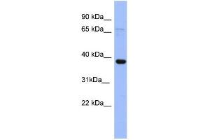 WB Suggested Anti-IER5 Antibody Titration: 0. (IER5 Antikörper  (N-Term))