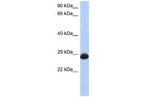 RAB39B antibody used at 1 ug/ml to detect target protein.
