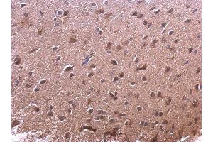 IHC-P Image AKR7A2 antibody detects AKR7A2 protein at cytoplasm on mouse fore brain by immunohistochemical analysis.