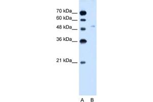 Western Blotting (WB) image for anti-Solute Carrier Family 2 (Facilitated Glucose Transporter), Member 6 (SLC2A6) antibody (ABIN2462758) (SLC2A6 Antikörper)