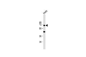 Anti-KRT10 Antibody (N-term) at 1:2000 dilution + Hela whole cell lysate Lysates/proteins at 20 μg per lane.