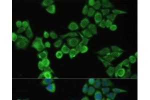 Immunofluorescence analysis of HeLa cells using Fibronectin Polyclonal Antibody at dilution of 1:100. (Fibronectin Antikörper)