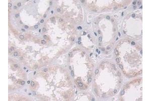 Immunohistochemistry (IHC) image for anti-ADAM Metallopeptidase with Thrombospondin Type 1 Motif, 10 (ADAMTS10) (AA 239-602) antibody (ABIN7443695)