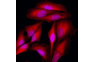 Immunofluorescence of HeLa cells stained with Hoechst 3342 (Blue) for nucleus staining and monoclonal anti-human KRT18 antibody (1:500) with Texas Red (Red).