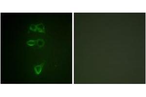 Immunofluorescence analysis of HepG2 cells, using TIE2 (Phospho-Tyr1108) Antibody. (TEK Antikörper  (pTyr1108))