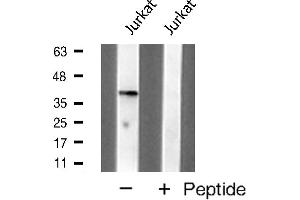 Western blot analysis of MKP1 expression in Jurkat cell extracts (DUSP1 Antikörper  (C-Term))