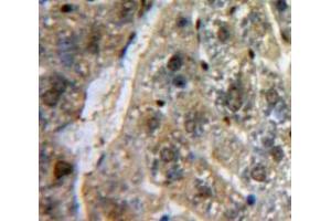 Used in DAB staining on fromalin fixed paraffin-embedded Liver tissue (SP100 Antikörper  (AA 261-465))