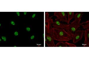 ICC/IF Image ADAR1 antibody [N3C1], Internal detects ADAR1 protein at nucleolus and nucleus by immunofluorescent analysis. (ADAR Antikörper)