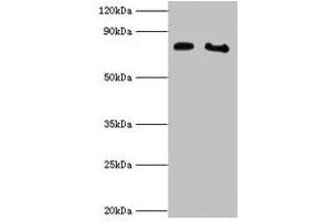 Western blot All lanes: POR antibody at 2 μg/mL Lane 1: K562 whole cell lysate Lane 2: A431 whole cell lysate Secondary Goat polyclonal to rabbit IgG at 1/10000 dilution Predicted band size: 77 kDa Observed band size: 77 kDa (POR Antikörper  (AA 2-671))