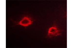 ABIN6267298 staining Hela cells by ICC/IF.