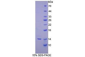 SDS-PAGE analysis of Human Inhibin beta C Protein. (INHBC Protein)