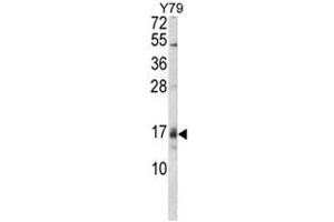 Western blot analysis of GADD45A Antibody (C-term) in Y79 cell line lysates (35ug/lane). (GADD45A Antikörper  (C-Term))