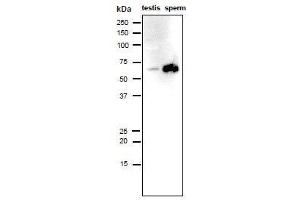 Western Blotting (WB) image for anti-Izumo Sperm-Egg Fusion 1 (IZUMO1) antibody (ABIN2452040) (IZUMO1 Antikörper)