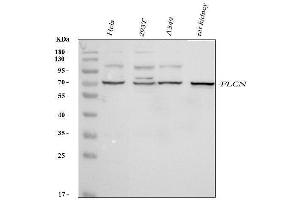 Western blot analysis of FLCN using anti-FLCN antibody (ABIN7602491).