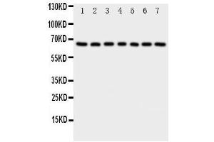 Western Blotting (WB) image for anti-NADPH Oxidase 4 (NOX4) (AA 561-578), (C-Term) antibody (ABIN3044011) (NADPH Oxidase 4 Antikörper  (C-Term))