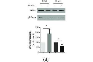 Western Blotting (WB) image for anti-Superoxide Dismutase 2, Mitochondrial (SOD2) (AA 25-222) antibody (ABIN3021904)