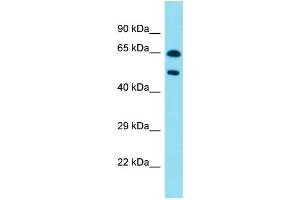 Host:  Rabbit  Target Name:  PAX8  Sample Type:  Pancreas Tumor lysates  Antibody Dilution:  1. (PAX8 Antikörper  (C-Term))
