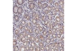 Immunohistochemical staining of human stomach with IGFALS polyclonal antibody  shows moderate cytoplasmic positivity in glandular cells at 1:50-1:200 dilution.