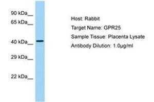 Image no. 1 for anti-G Protein-Coupled Receptor 25 (GPR25) (AA 166-215) antibody (ABIN6750185) (GPR25 Antikörper  (AA 166-215))
