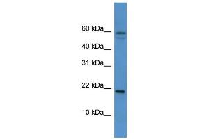 WB Suggested Anti-Hspb7 Antibody Titration:  0.