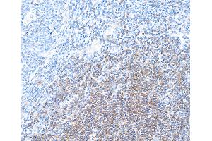 Immunohistochemistry (IHC) image for anti-CD28 (CD28) (AA 19-140) antibody (ABIN7448899) (Rekombinanter CD28 Antikörper  (AA 19-140))