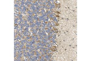 anti-Poliovirus Receptor-Related 1 (Herpesvirus Entry Mediator C) (PVRL1) (AA 32-237) antibody