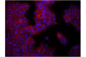 Immunofluorescence (IF) image for anti-Integrin beta 1 (ITGB1) antibody (ABIN2664520) (ITGB1 Antikörper)