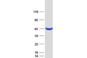 Western Blotting (WB) image for Nucleoside Diphosphate Kinase (NME7) (Transcript Variant 2) protein (Myc-DYKDDDDK Tag) (ABIN2727409)