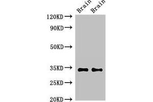 Western Blot Positive WB detected in: Mouse brain tissue, Rat brain tissue All lanes: NPY6R antibody at 2. (NPY6R Antikörper  (AA 1-39))