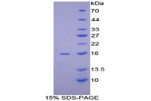 SDS-PAGE analysis of Human aHSP Protein. (aHSP Protein)