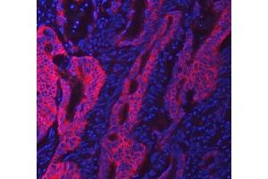 IF analysis of SWAP70 using anti-SWAP70 antibody (ABIN7600201). (SWAP70 Antikörper  (AA 161-292))