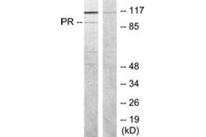 Western blot analysis of extracts from COS7 cells, treated with EGF, using Progesterone Receptor (Ab-190) Antibody. (Progesterone Receptor Antikörper  (AA 161-210))