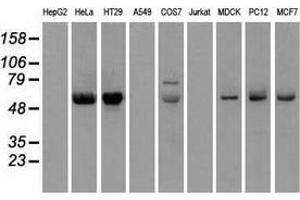 Western blot analysis of extracts (35 µg) from 9 different cell lines by using anti-CHEK2 monoclonal antibody. (CHEK2 Antikörper)