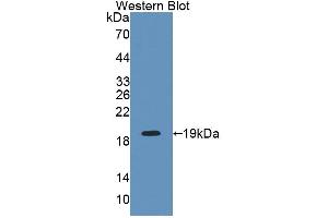 Western Blotting (WB) image for anti-Inositol Polyphosphate-4-Phosphatase, Type I, 107kDa (INPP4A) (AA 1-137) antibody (ABIN1868712)
