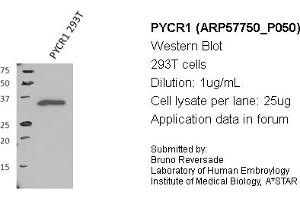 Image no. 1 for anti-Pyrroline-5-Carboxylate Reductase 1 (PYCR1) (Middle Region) antibody (ABIN2787369) (PYCR1 Antikörper  (Middle Region))