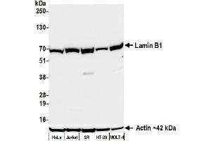 Western Blotting (WB) image for anti-Lamin B1 (LMNB1) (AA 450-500) antibody (ABIN7795809)