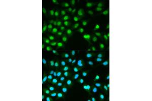 Immunofluorescence analysis of HeLa cell using PPP3CA antibody. (PPP3CA Antikörper  (AA 1-511))