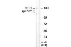 Western blot analysis of extracts from HepG2 cells, using NEK9 (Phospho-Thr210) Antibody. (NEK9 Antikörper  (pThr210))