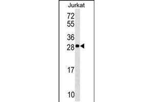 Western blot analysis in Jurkat cell line lysates (35ug/lane). (ANP32C Antikörper  (AA 130-158))