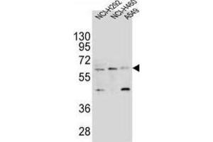 Western Blotting (WB) image for anti-Leukocyte Immunoglobulin-Like Receptor, Subfamily A (With TM Domain), Member 2 (LILRA2) antibody (ABIN2995659) (LILRA2 Antikörper)