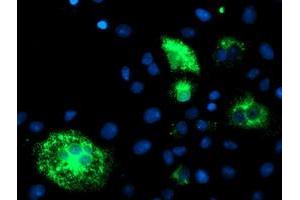 Anti-DHFRL1 mouse monoclonal antibody (ABIN2454838) immunofluorescent staining of COS7 cells transiently transfected by pCMV6-ENTRY DHFRL1 (RC208452). (DHFRL1 Antikörper  (AA 4-185))